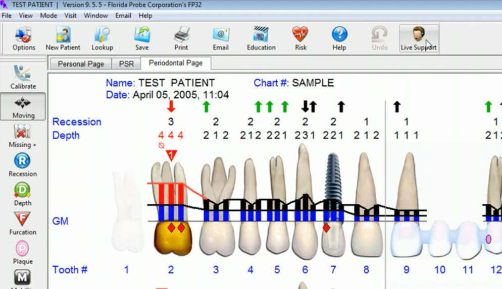 Software 32. Пародонтограмма Флорида Проуб. Пародонтальная карта Florida Probe. Система Флорида Проуб. Флорида Проуб в стоматологии.