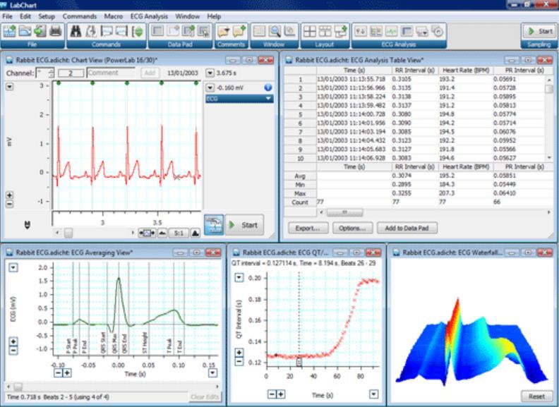 ADInstruments ECG Analysis download for free - SoftDeluxe
