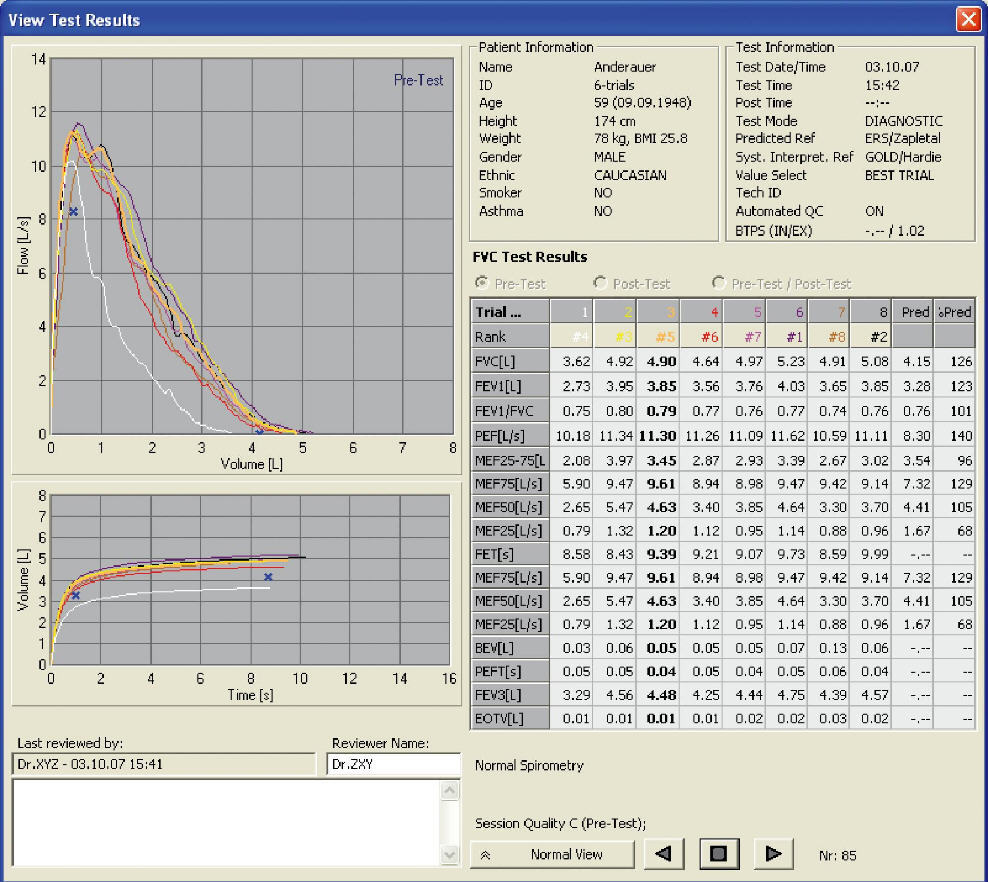 EasyChecker - Screenshot #1