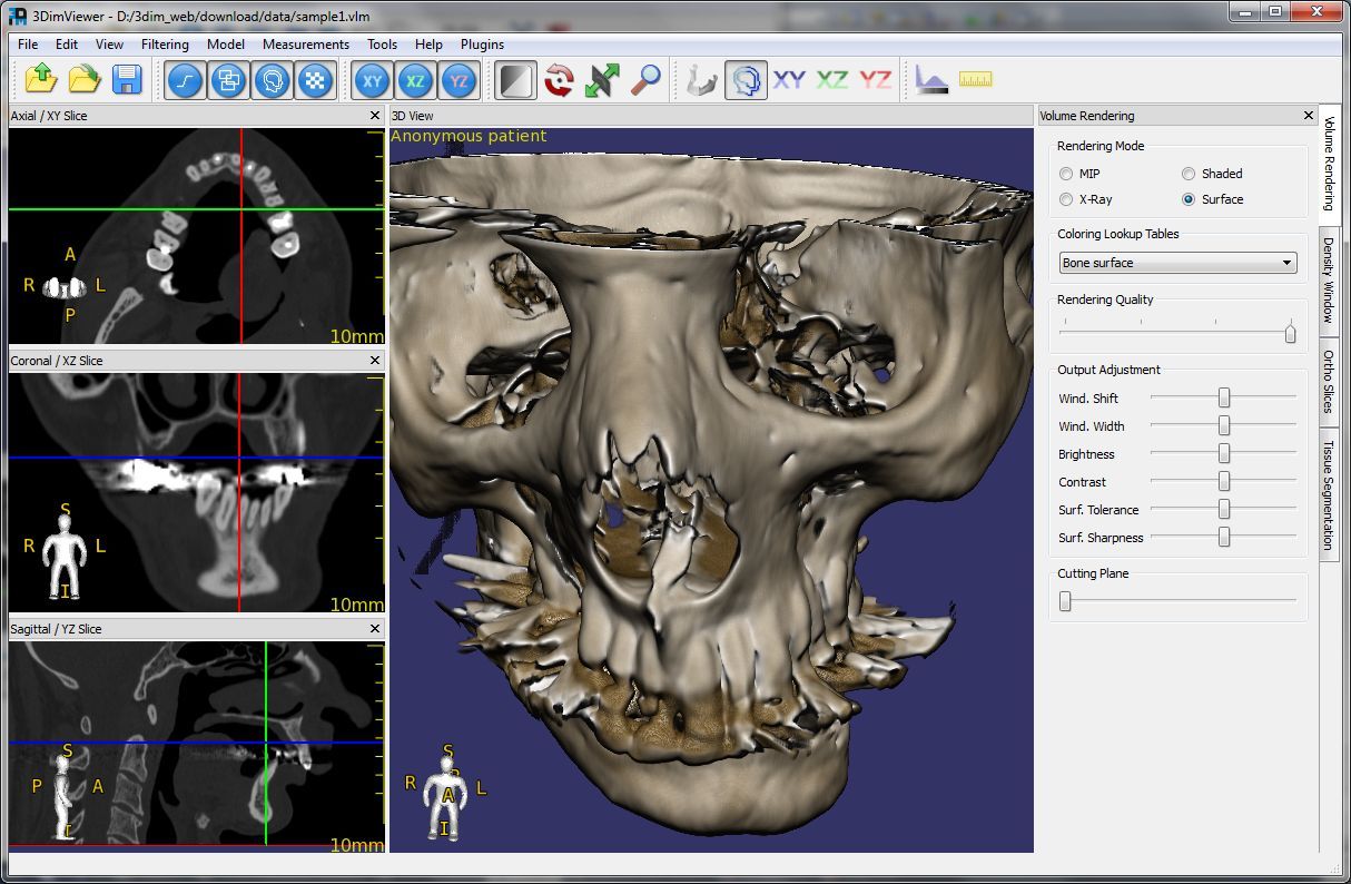 Dicom web viewer. Dicom viewer 3.1.4. 3dimviewer. Radiant Dicom viewer. Dicom снимки.