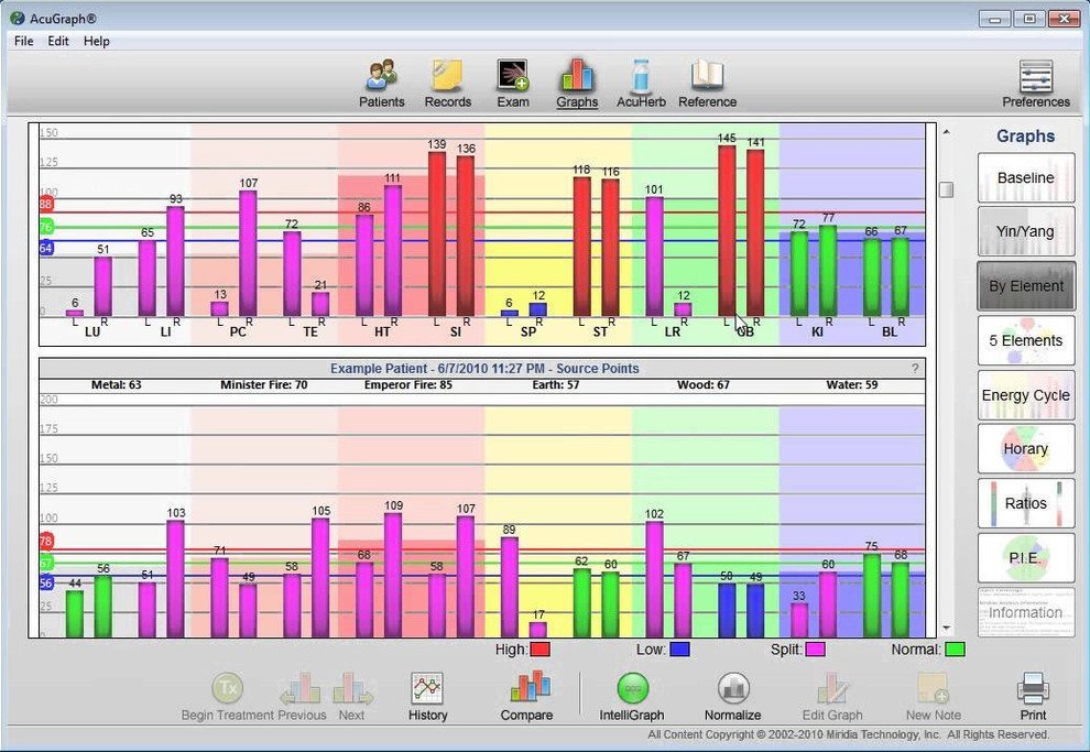 AcuGraph download for free - SoftDeluxe