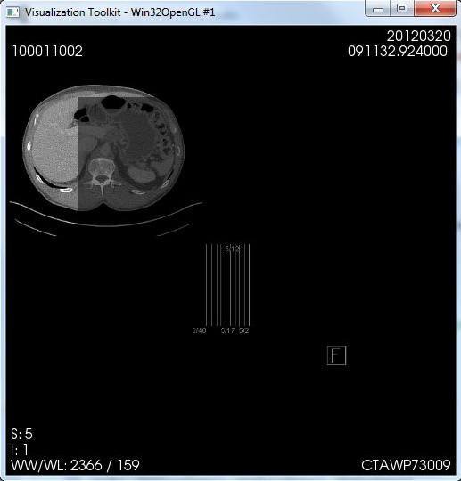 GDCM - Screenshot #1