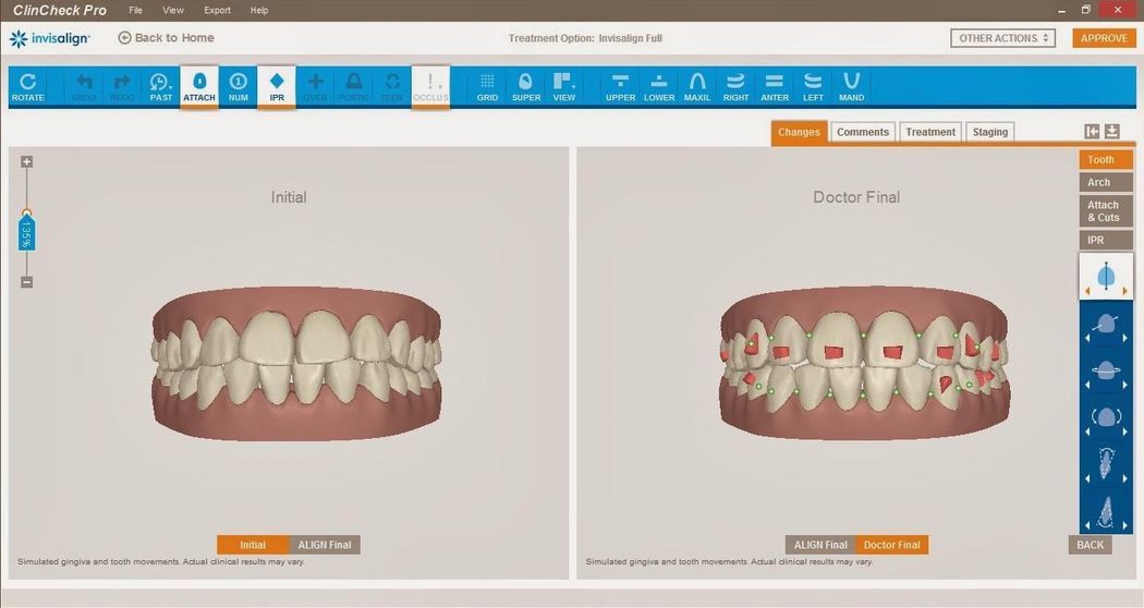 ClinCheck Pro download for free - SoftDeluxe