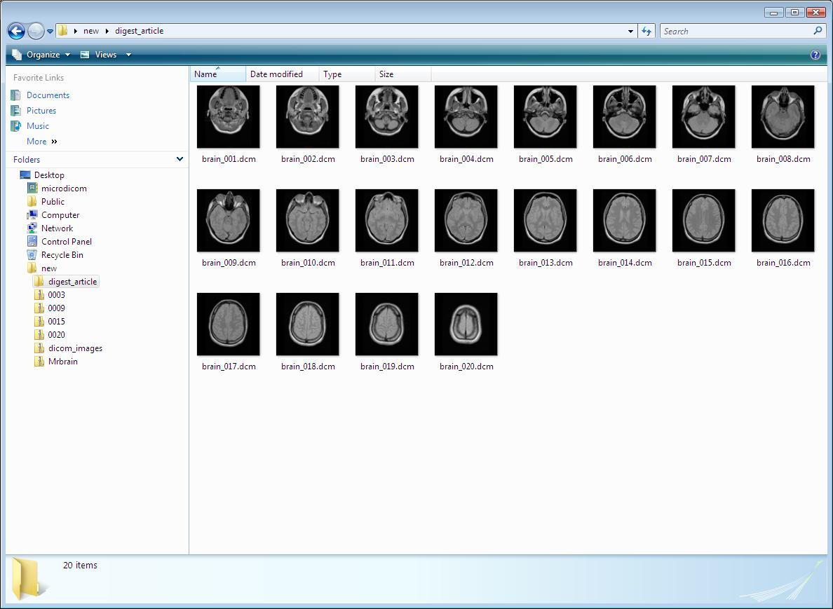 Microdicom viewer. Dicom программа ярлык. MICRODICOM 3d картинка. Номер модальности в Dicom.